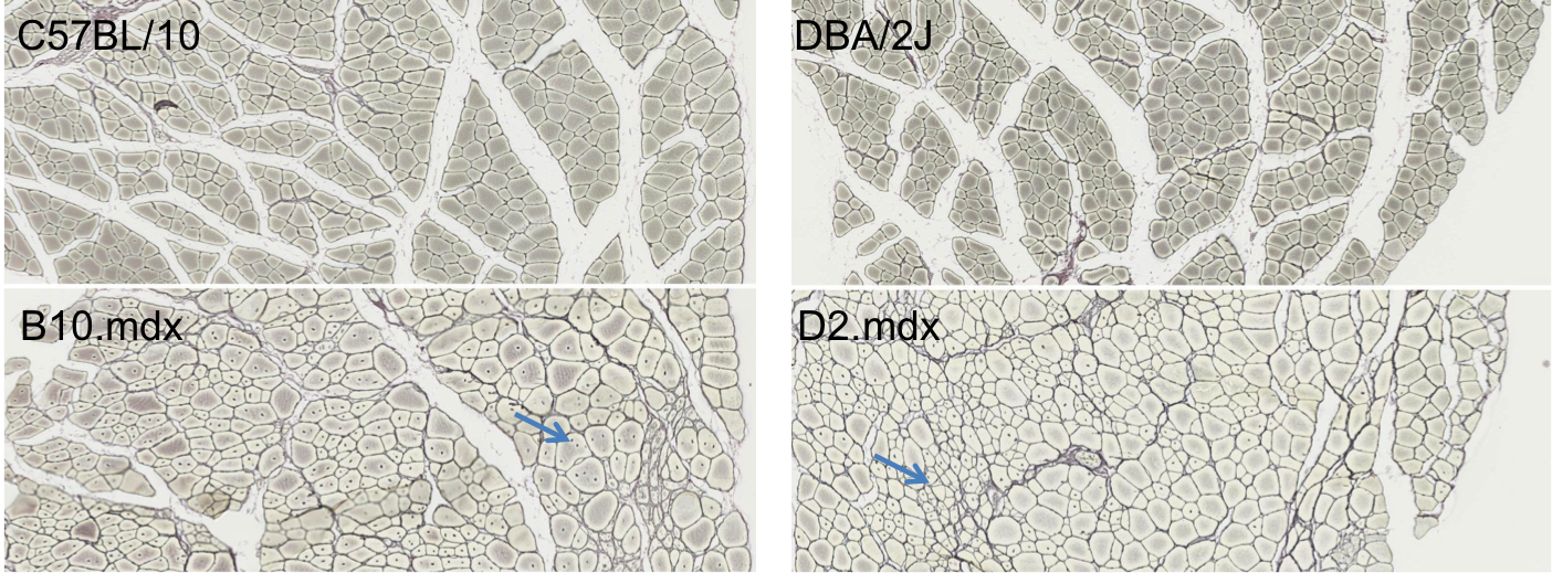 histology_mdx