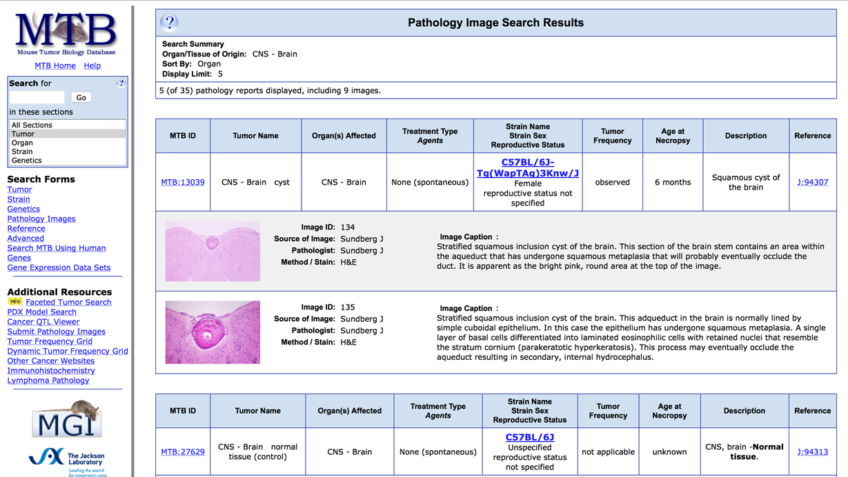 MTB Pathology Image Search Results