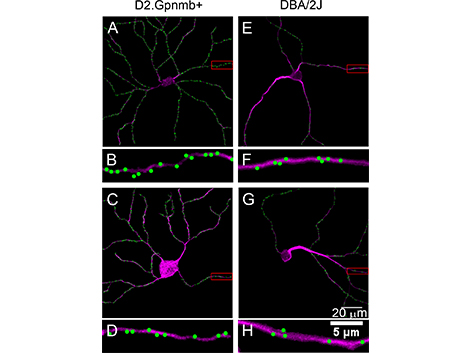 rbcs and glaucomatous