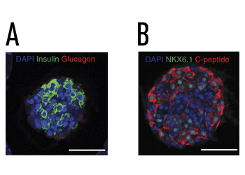 encapsulated human sc-beta cells