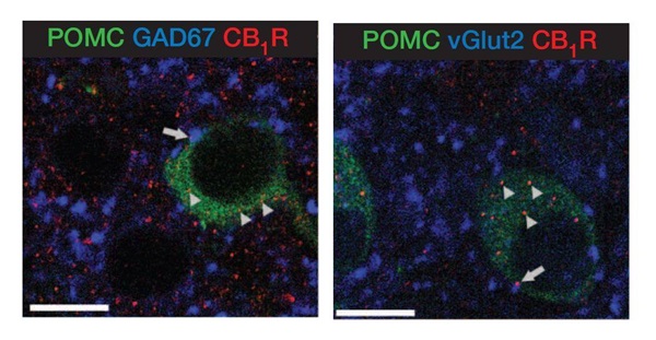 POMC-EGFP mice C57BL/6J-Tg(Pomc-EGFP)1Low/J, (009593)