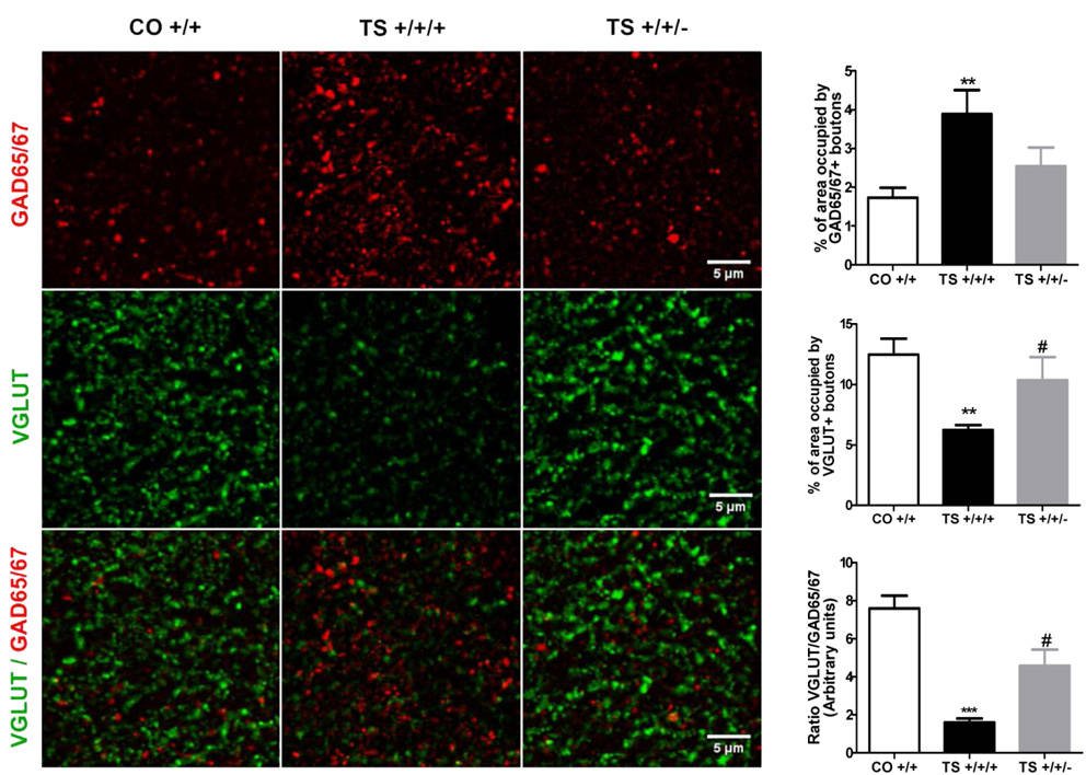 Potential new Therapeutic Target for Treating Down Syndrome