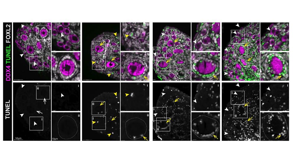 An example of research from The Jackson Laboratory's Associate Professor Ewelina Bolcun-Filas, Ph.D.