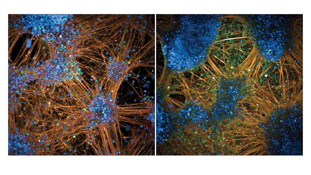 Stains identify neuronal progenitor cell types found in different layers of the cerebral cortex.