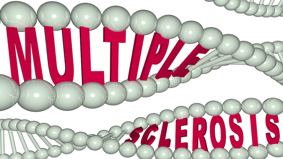 Word art of multiple sclerosis in DNA strand