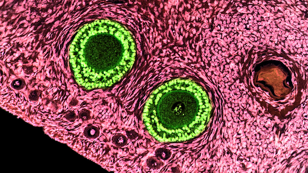 Ovarian follicles