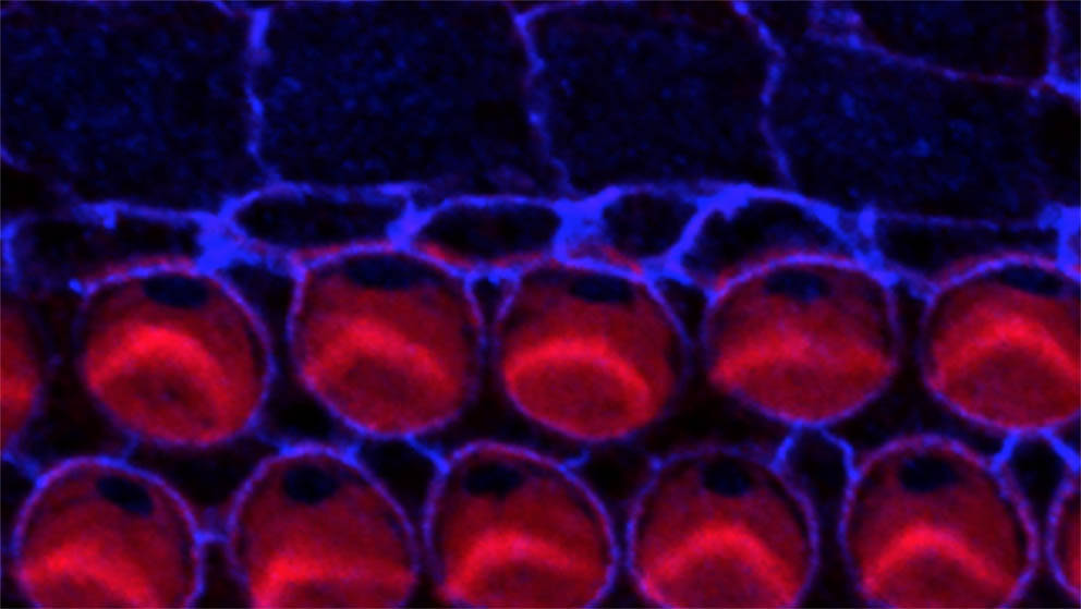 Basile Tarchini hearing loss research