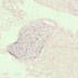 Aqp2 kidney