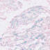 Myc cardiac tissue